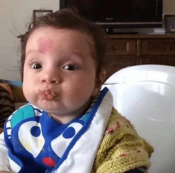 El bebé del amor nació con una mancha en forma de corazón y es viral